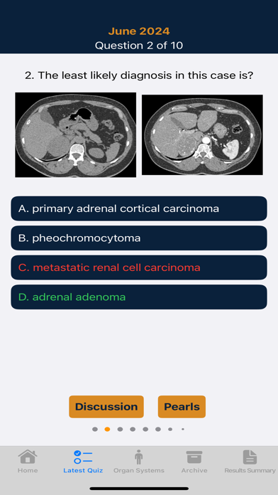 CTisus iQuiz 25 Screenshot