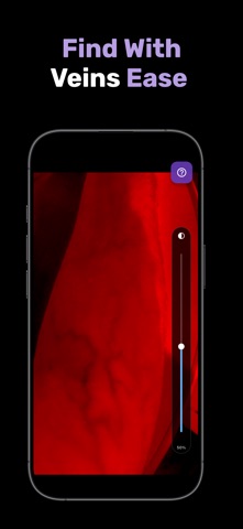 X-Vein screenshot 1