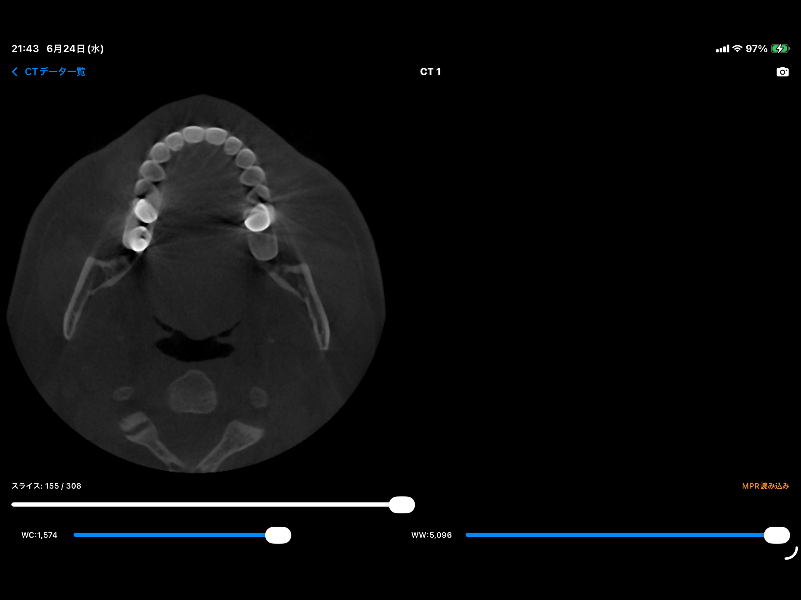 DentalCT screenshot 5
