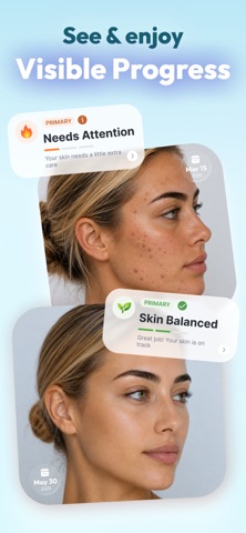 SkinWise: AI Skinсare Scanner screenshot 6