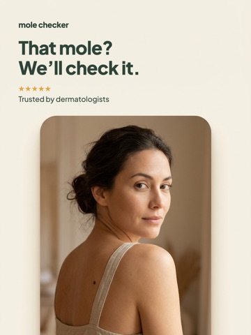 Mole Checker: Skin Scanner iPad screenshot