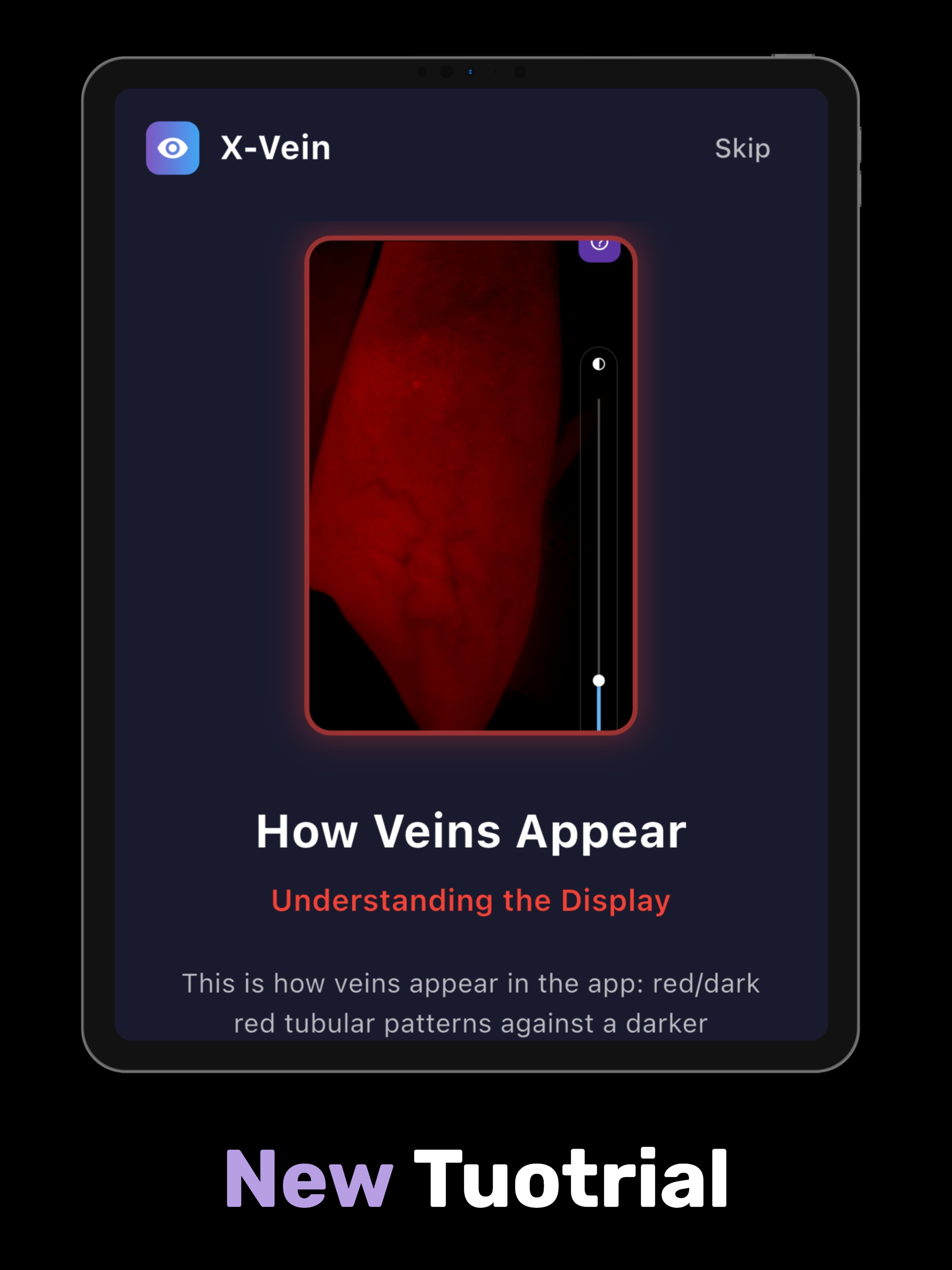 X-Vein pro