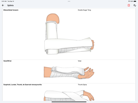 palmEM AI: EM Quick Reference iPad screenshot 3 - Medical app
