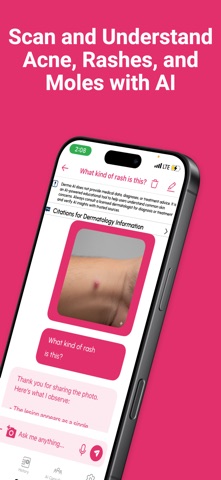 Derma AI: AI for Dermatology iPhone screenshot