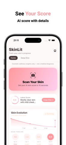 SkinLit: Skin Analysis screenshot
