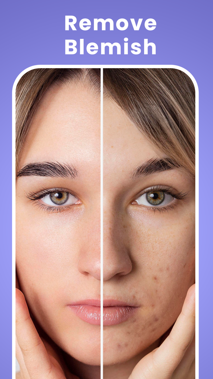 Eraser - AI Photo Retouch