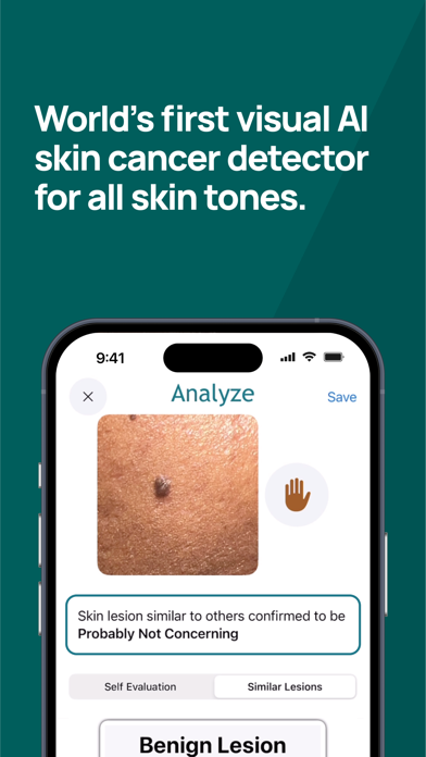 Skin-Check Screenshot