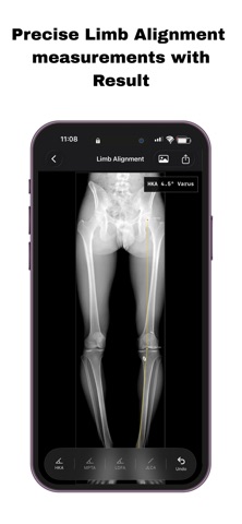 OsteoPlan screenshot