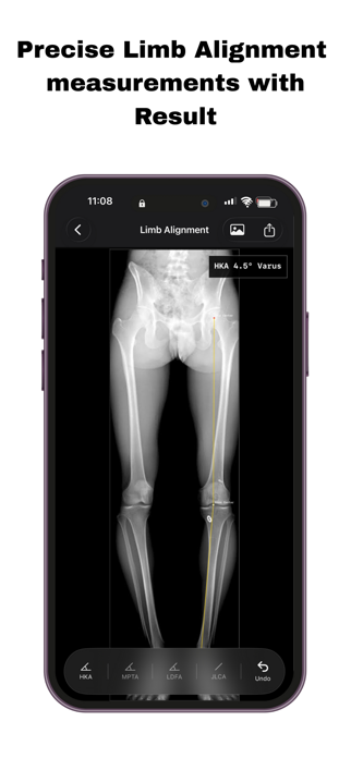 OsteoPlan Screenshot 7 of 10