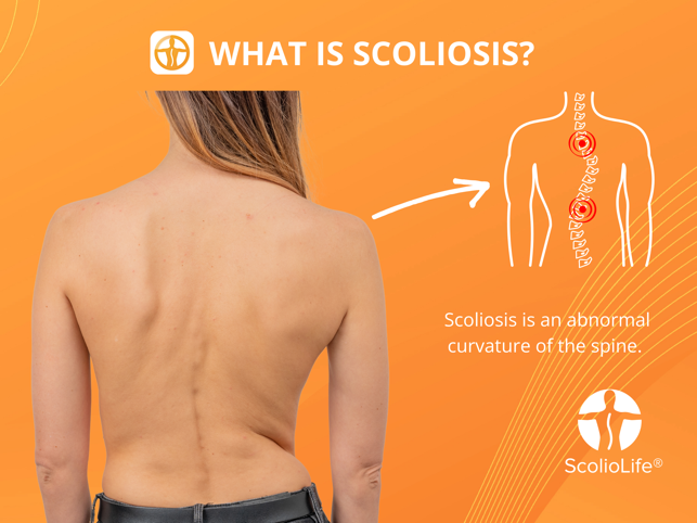 Scoliometer Screenshot