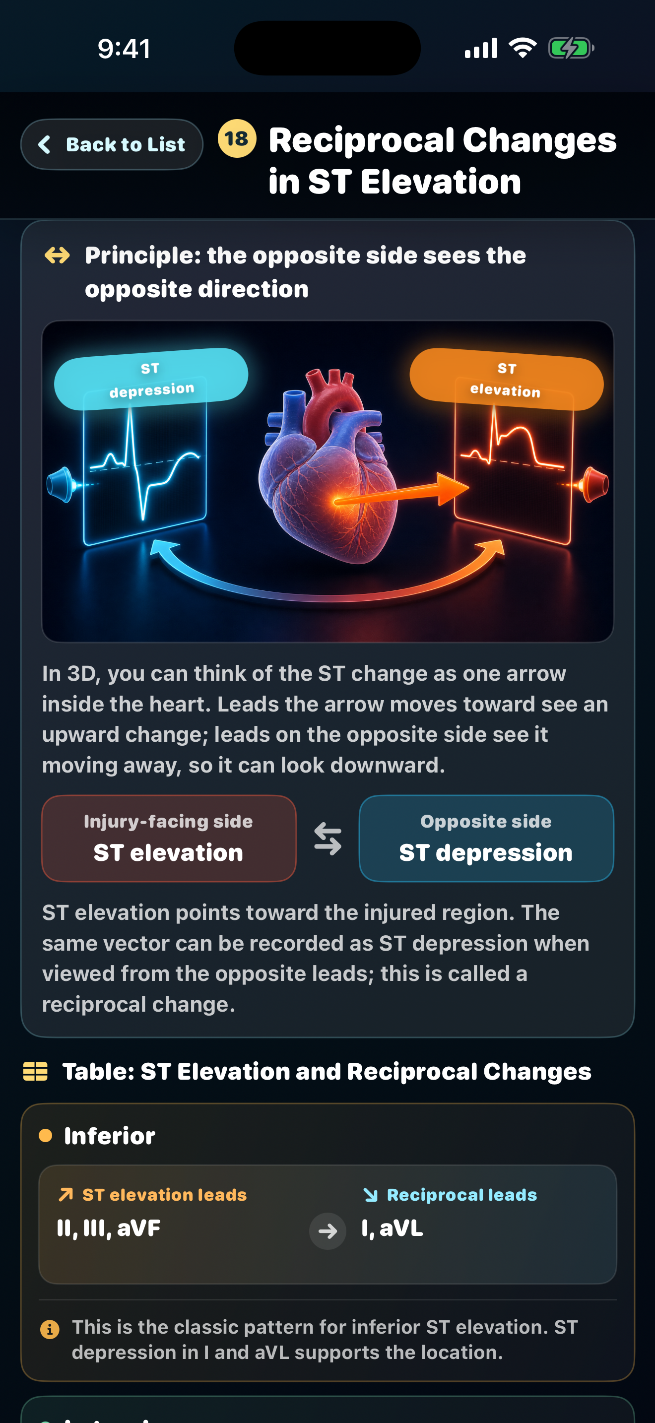 ECG Trainer: Monitor & 12-Lead screenshot 3