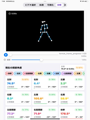 MoveScope iPad screenshot