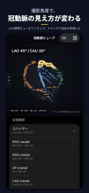 CAGView 冠動脈ビューア screenshot 4