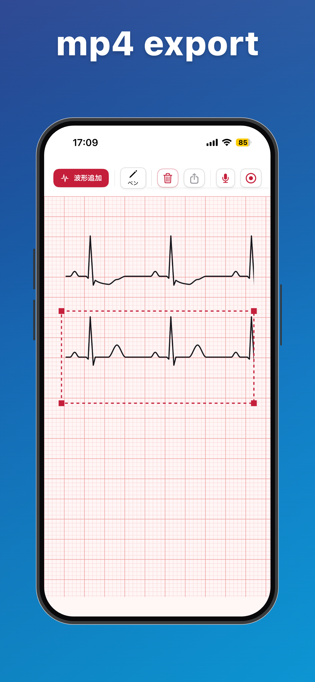 ECGStudio: ECG Draw & Lecture screenshot 3