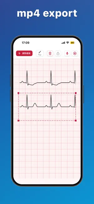 ECGStudio: ECG Draw & Lecture screenshot 3