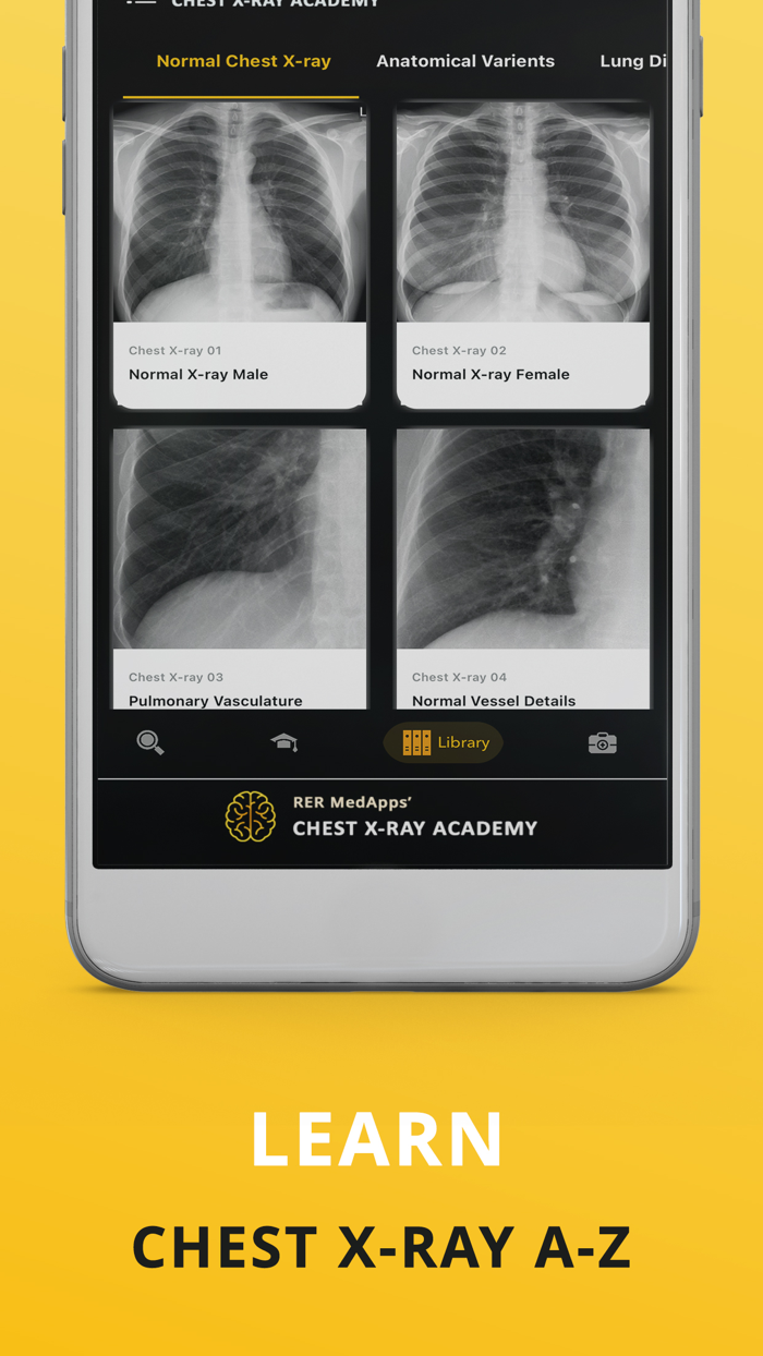 Chest X-ray Academy Learn CXR