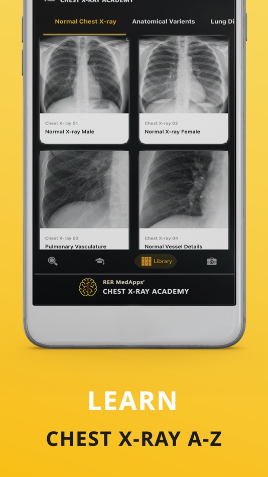 #2. Chest X-ray (CXR) Made Easy (iOS) Podle: RER MedApps
