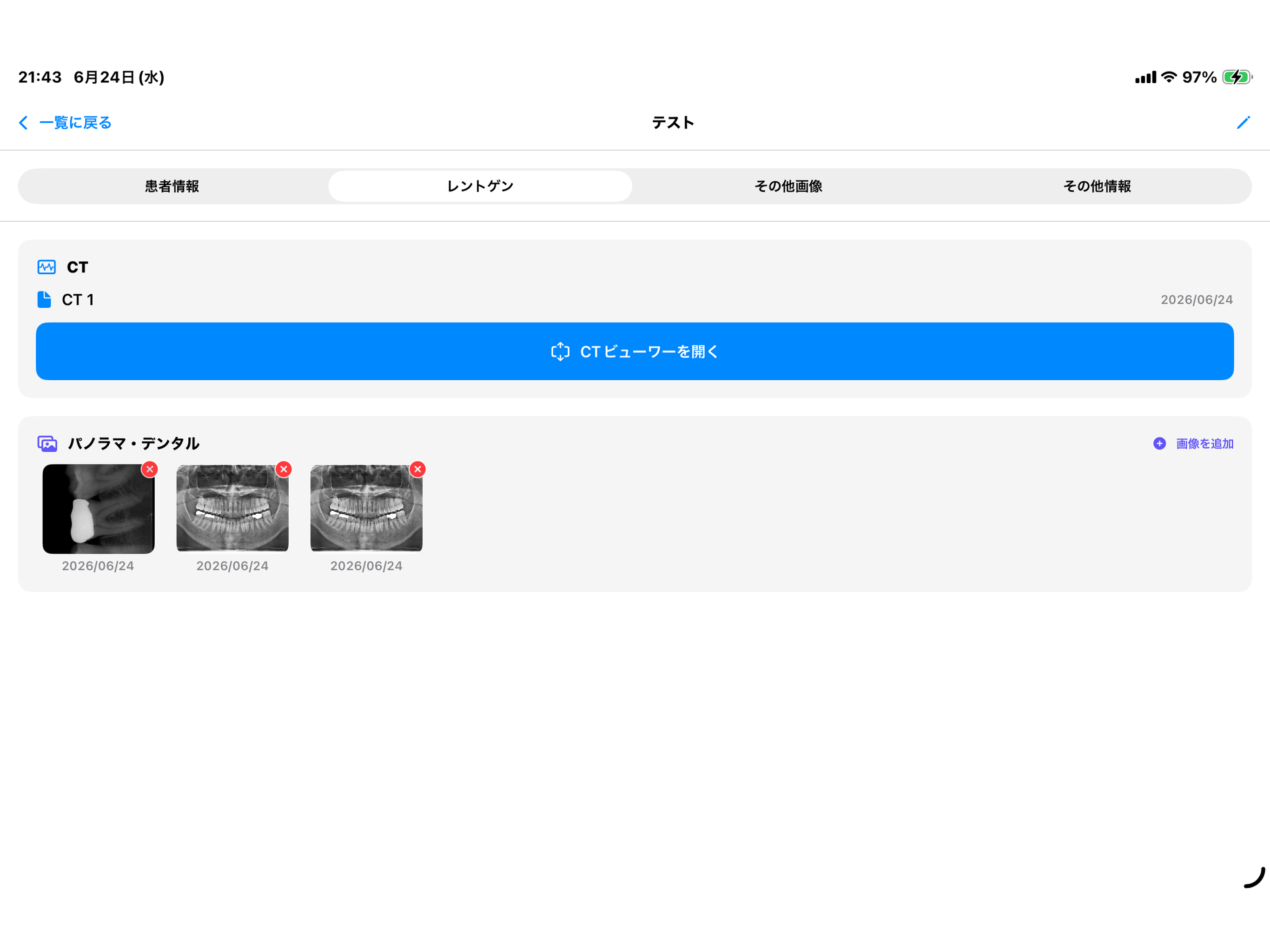 DentalCT screenshot 7