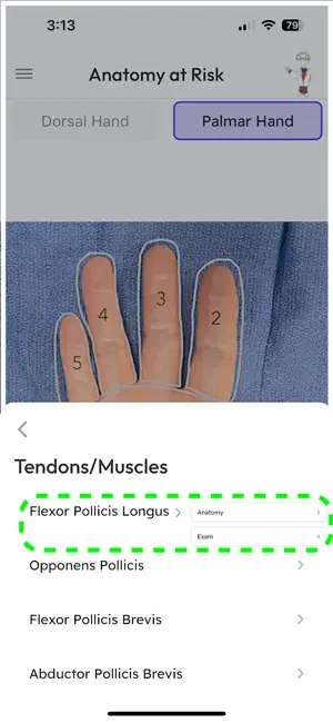 Anatomy at Risk screenshot 4