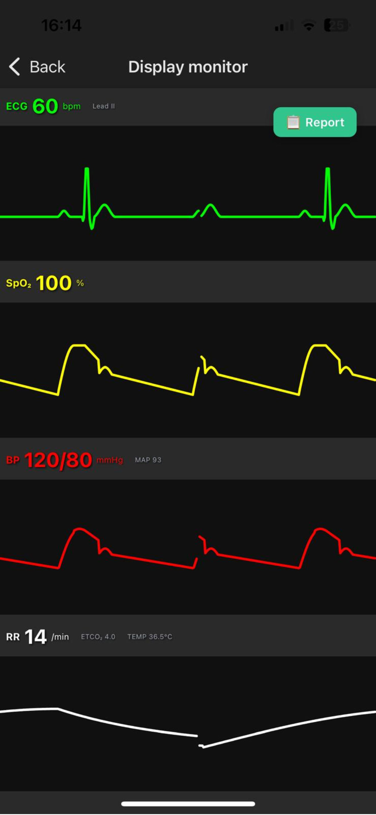 ResusSim-Monitor screenshot 3