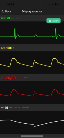 ResusSim-Monitor screenshot