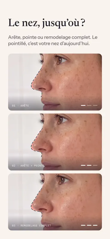 Chirurgie Esthétique : Mevona screenshot 3 of 8