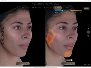 Aura 3D Imaging screenshot 4