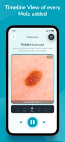 Family Mole Tracker screenshot