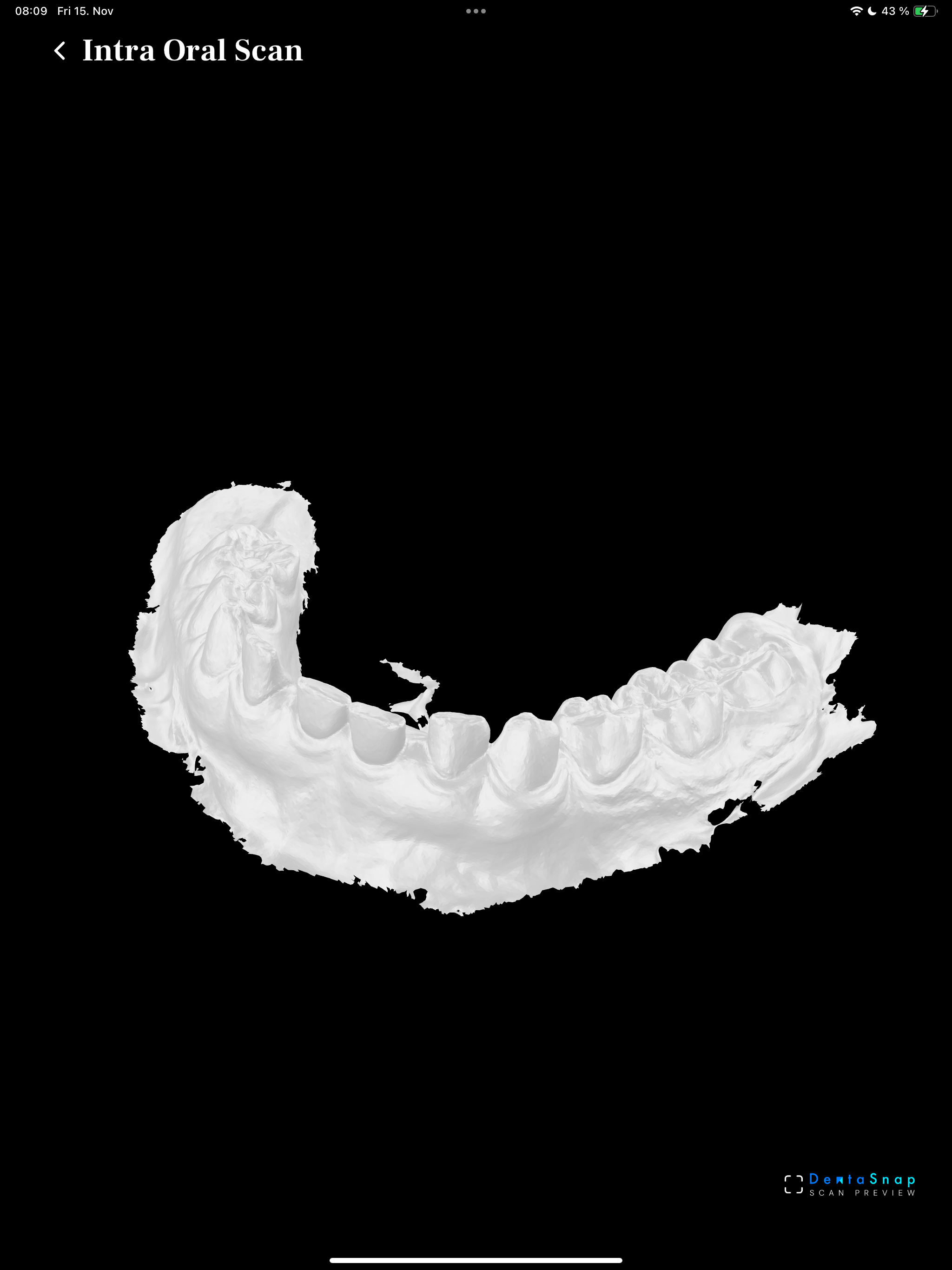 DentaSnap v2