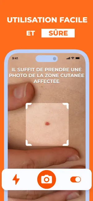 Scanner IA Santé de Peau iPhone screenshot 3
