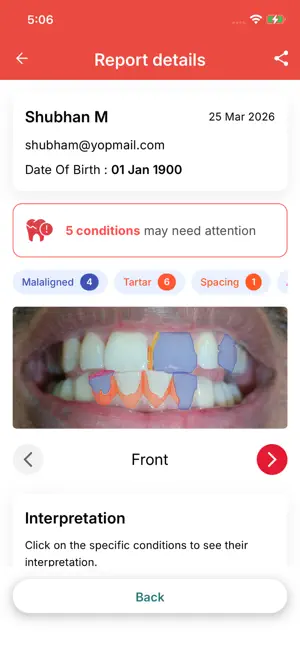 Illusion Aligners screenshot 3
