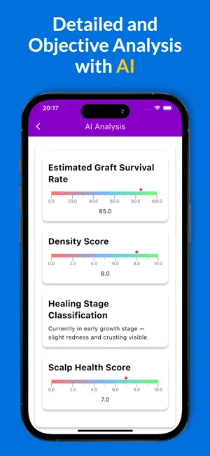 Graft Count - Hair Transplant screenshot 2