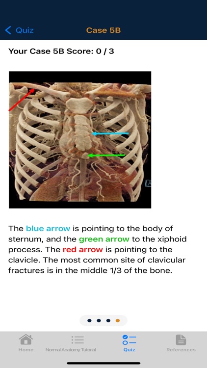 CTisus Chest Atlas 3D CRT screenshot-8
