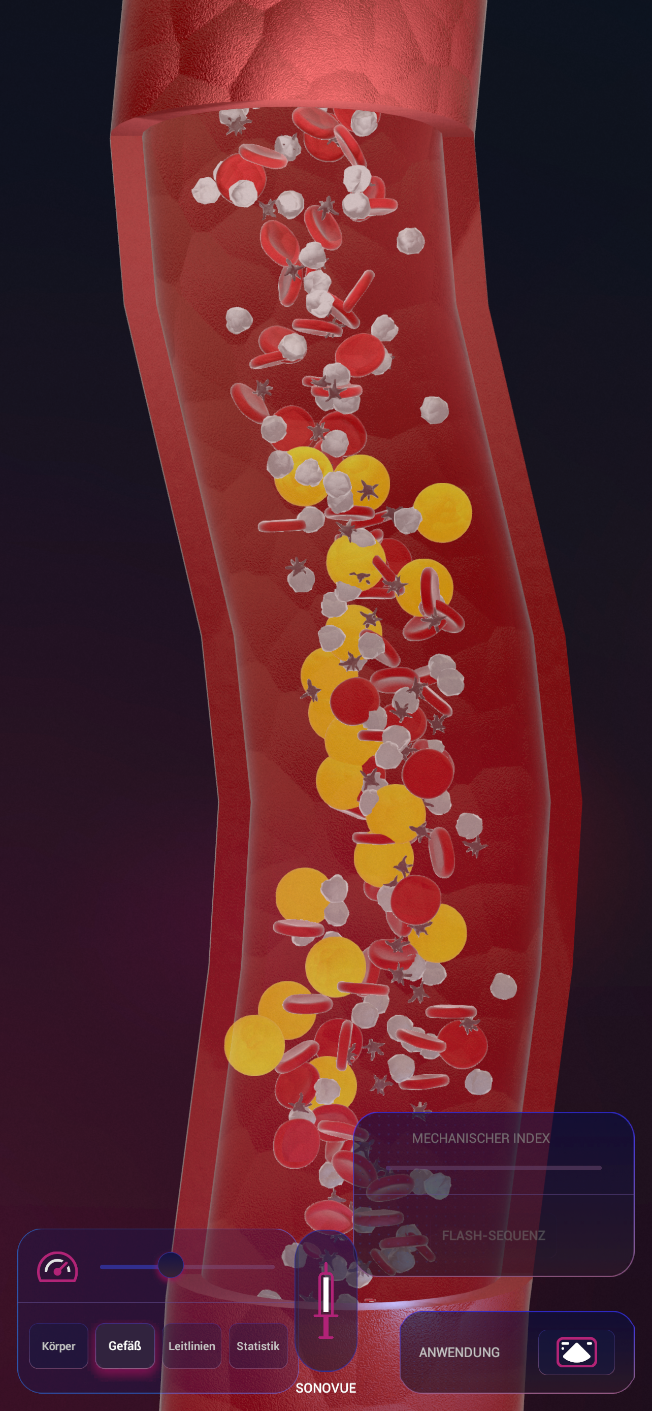SonoVue screenshot 6