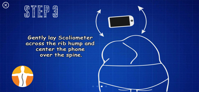 Tangkapan Layar Skoliometer