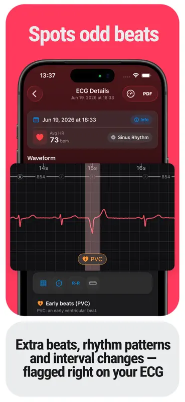 EKG Tracker+ HRV, QTc & Leser screenshot 2 of 6
