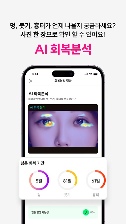 페이스핏 - 성형,견적,상담,분석,시술,얼굴,시뮬레이션 screenshot-5