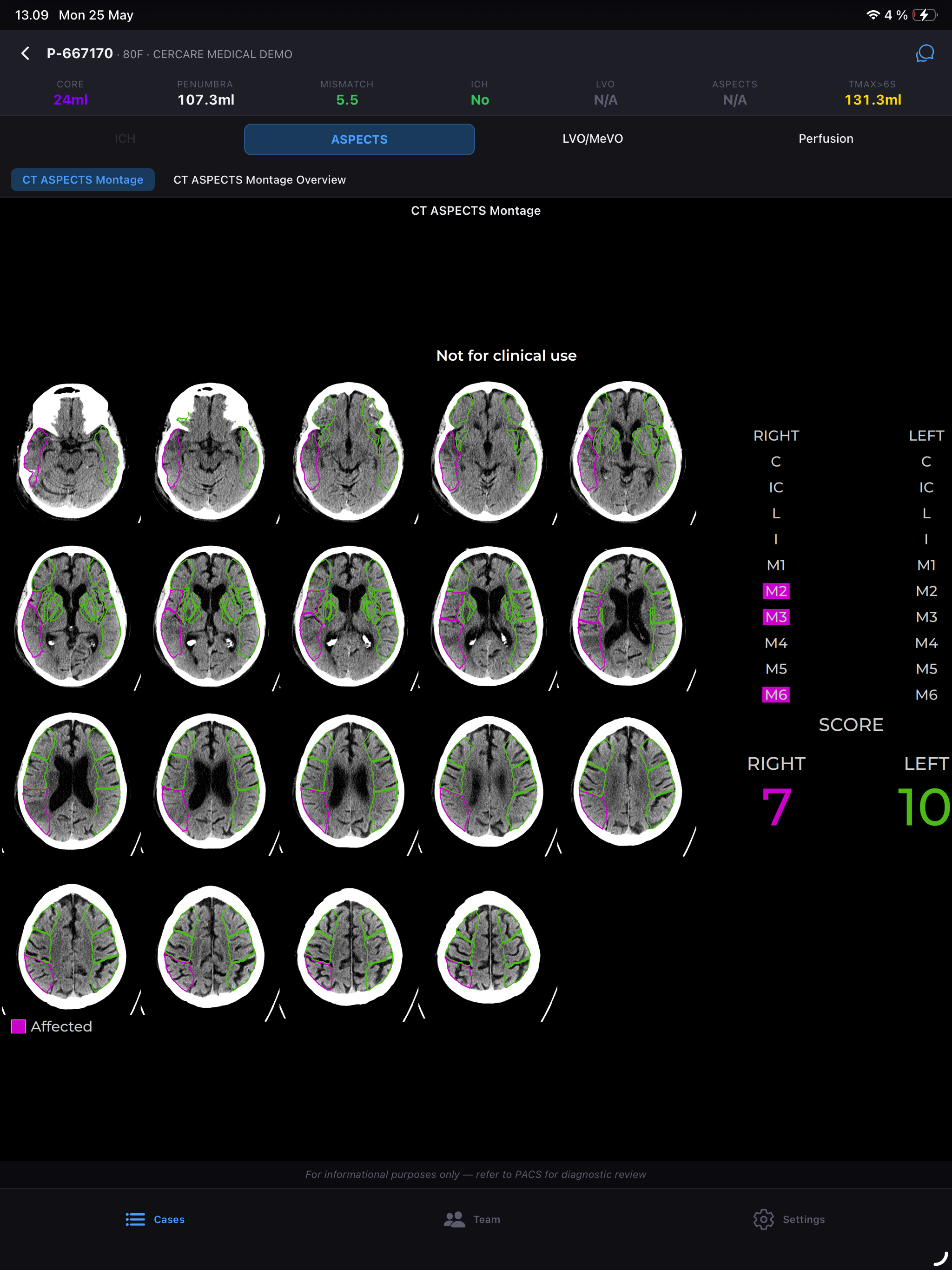 Cercare Mobile screenshot 3