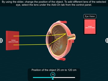 Vision Defects – EduTech Era iPad screenshot