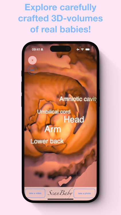 ScanBaby learn baby ultrasound screenshot-4