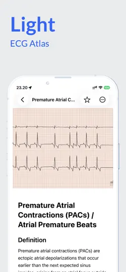 Screenshot von ECG Atlas auf dem iPhone 4