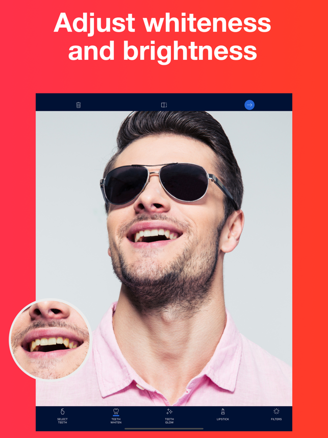 ‎Teeth Whitener AI Photo Editor Screenshot