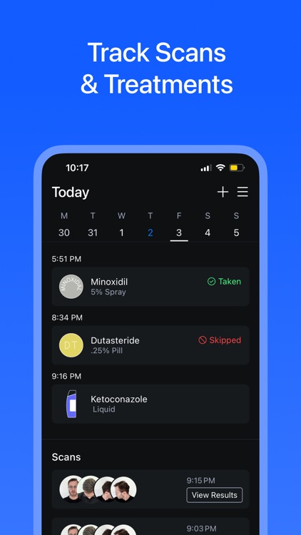 Hair Loss AI therapy & scanner
