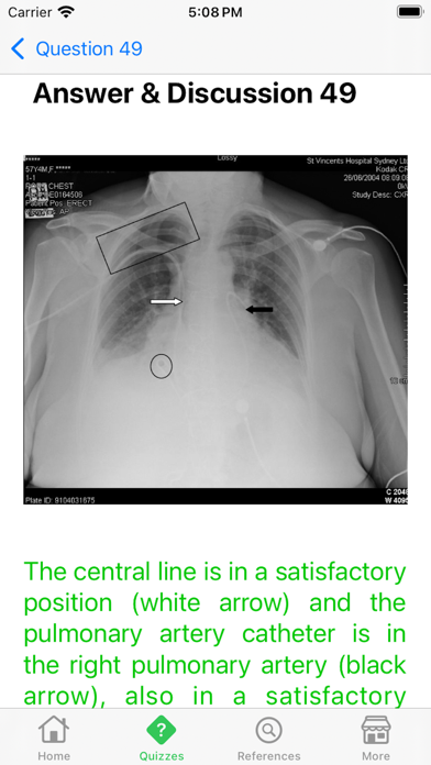 Screenshot #3 pour X-Ray Interpretation Guide