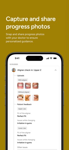 Smilexcel Clear Aligners Screenshot 6 of 7