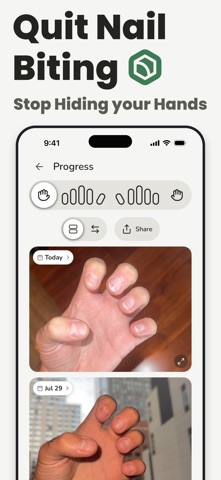 Stop Nail Biting: Nonyxa Screenshot 1 of 9