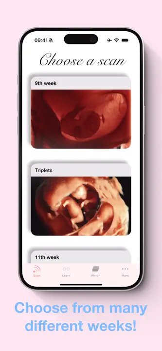 ScanBaby learn baby ultrasoundのスクリーンショット（4/8）