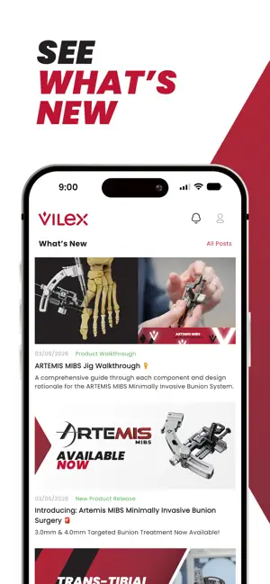 Vilex screenshot 1