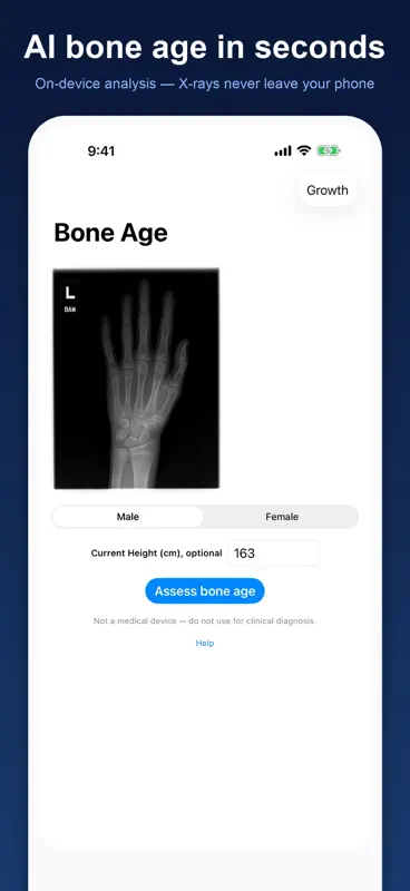Bone Age: X-Ray Image Rater screenshot 4 of 5