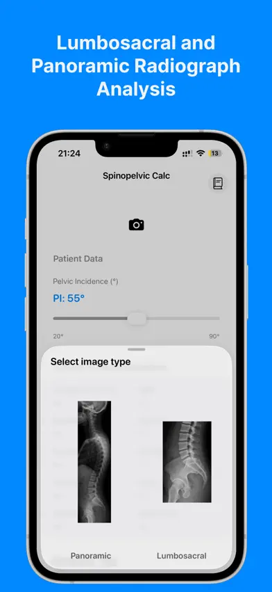 Spinopelvic Calc screenshot 2